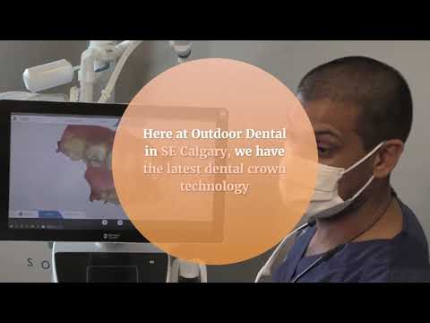 How long does it take to get a Dental Crown? One Visit Dental Crowns Calgary SE