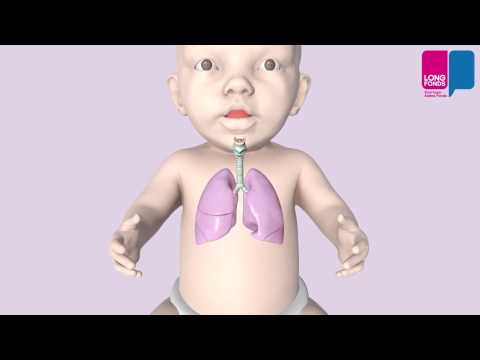 RS virus - wat gebeurt er in je longen?